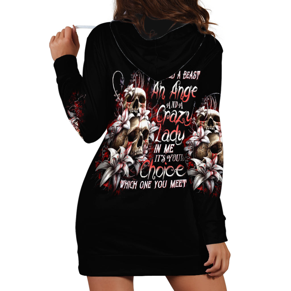 Blood Skull Hoodie Dress I Hold A Angel And Crazy Lady It Your Choice - Wonder Print Shop