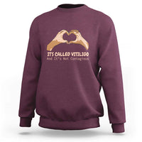 Maroon sweatshirt with heart-hand graphic and "It’s Called Vitiligo" text